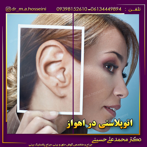 اتوپلاستی در اهواز