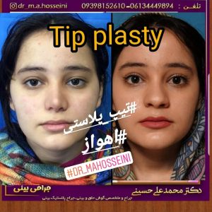 تیپ پلاستی در اهواز