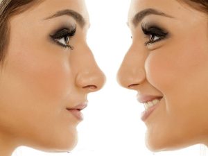 شاخص تفاوت بین جراحی بینی گوشتی و استخوانی