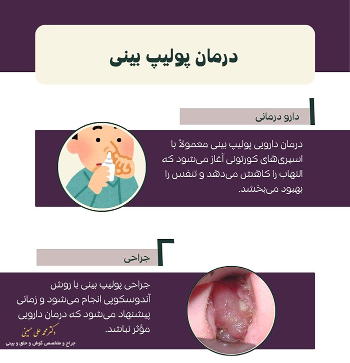 درمان پولیپ بینی
