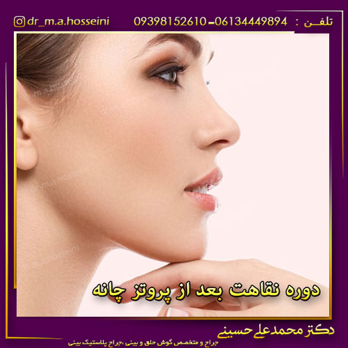دوره نقاهت بعد از پروتز چانه