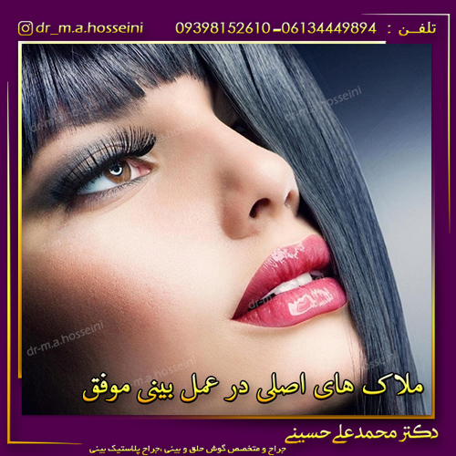 ملاک های اصلی در عمل بینی موفق