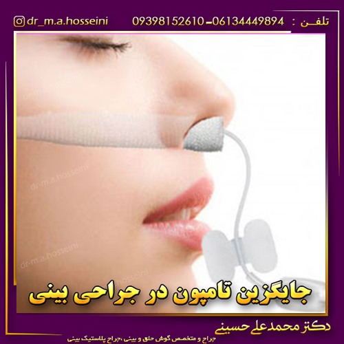 جایگزین تامپون در جراحی بینی
