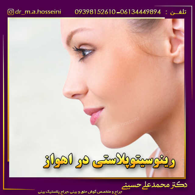 رینوسیتوپلاستی در اهواز