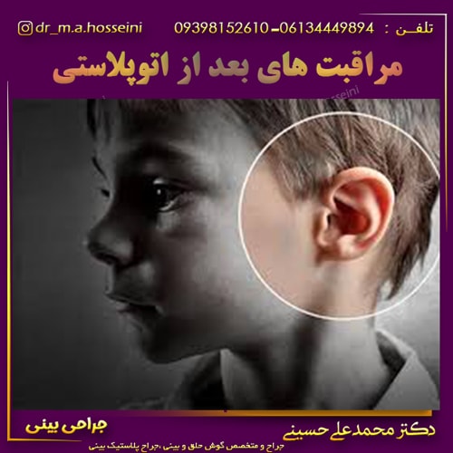 مراقبت های بعد از اتوپلاستی