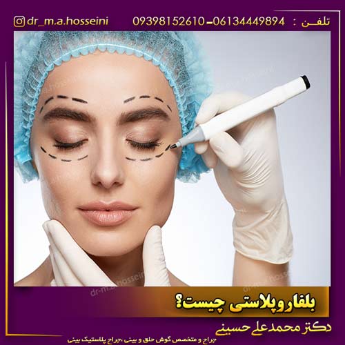 بلفاروپلاستی چیست؟