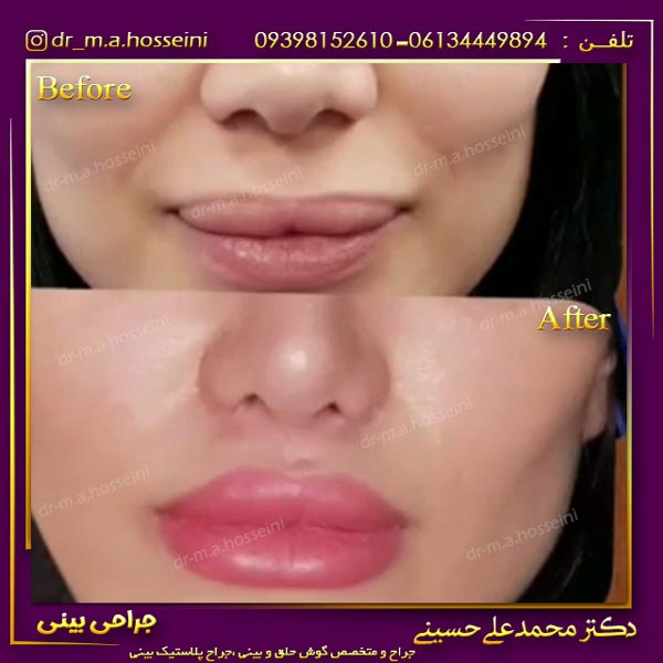 عمل سانترال لب