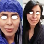 قبل و بعد سانترال لب