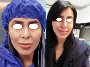 قبل و بعد سانترال لب