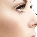 جراحی بینی نیمه فانتزی
