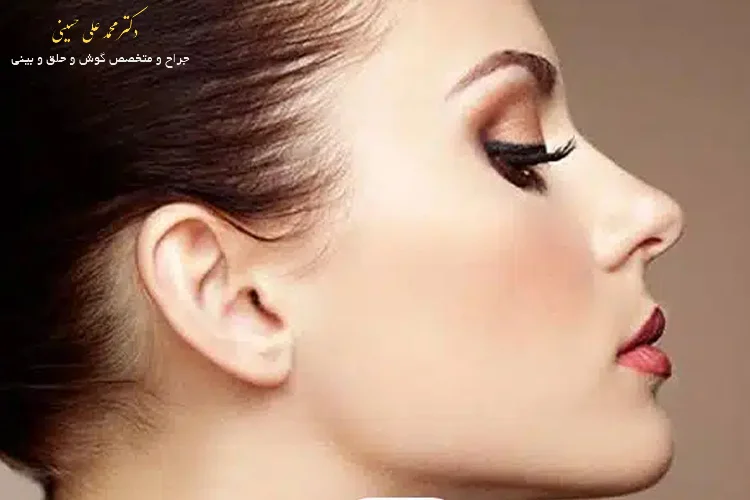 عمل بینی نیمه فانتزی 