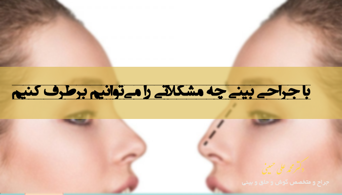 با جراحی بینی چه مشکلاتی را می توانیم برطرف کنیم