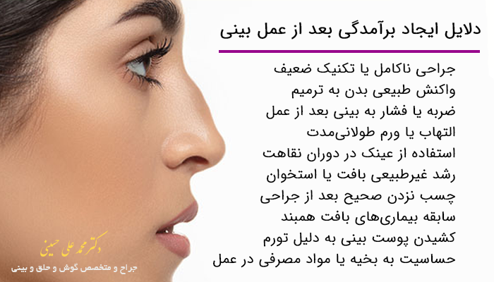 دلایل ایجاد برآمدگی بعد از عمل بینی