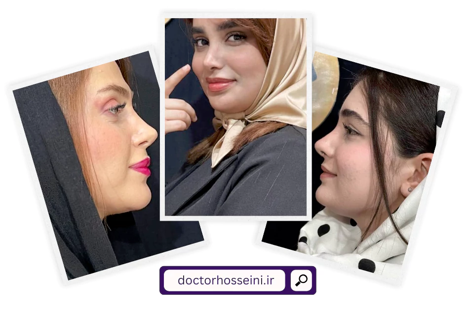 نمونه عمل بینی