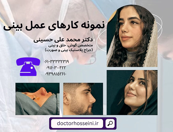 نمونه عمل بینی در اهواز دکتر محمد علی حسینی