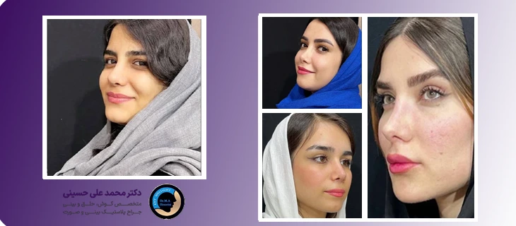 نمونه کارهای بهترین جراح بینی اهواز