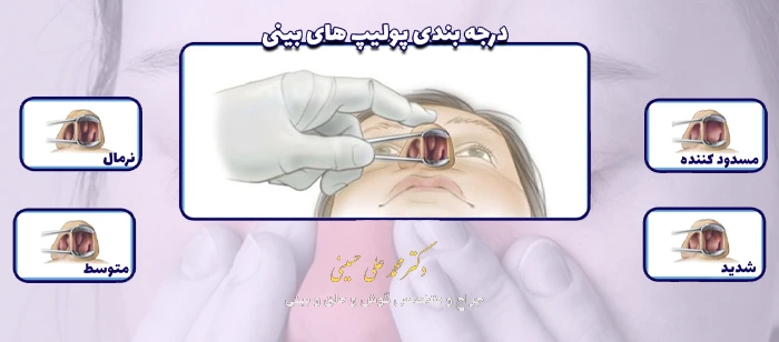 درجه بندی پولیپ بینی