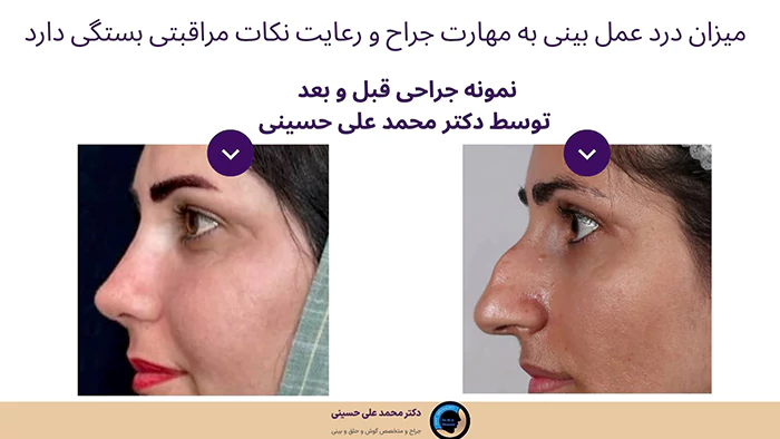 درد جراحی بینی