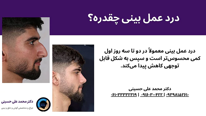 درد عمل بینی چقدره؟