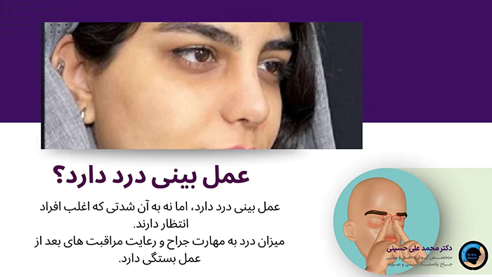 عمل بینی درد دارد؟