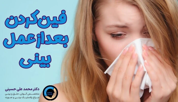 فین کردن بعد از جراحی بینی