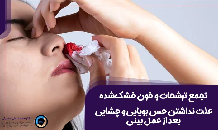 علت نداشتن حس بویایی و چشایی بعد از عمل بینی