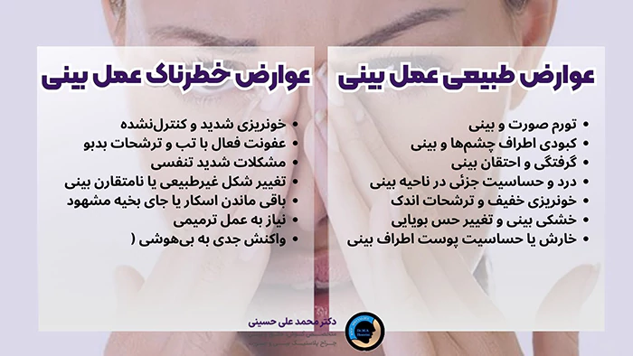 عوارض جراحی بینی