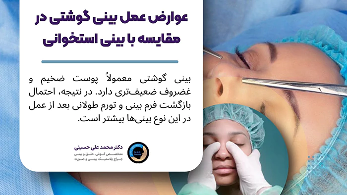 عوارض عمل بینی گوشتی در مقایسه با بینی استخوانی
