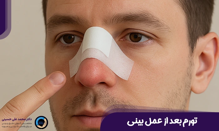 ورم بعد از عمل بینی