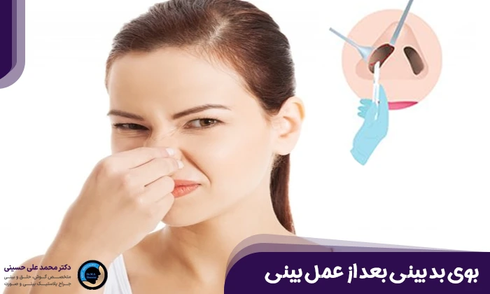 بوی بد بینی بعد از عمل بینی