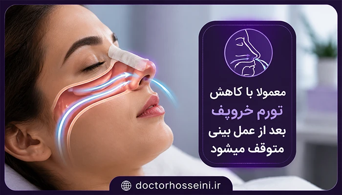 خروپف بعد از عمل جراحی بینی