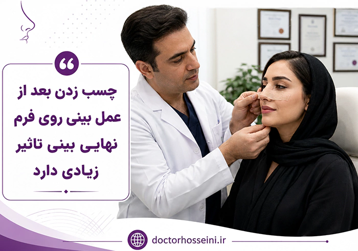 اهمیت چسب زدن به بینی بعد از عمل