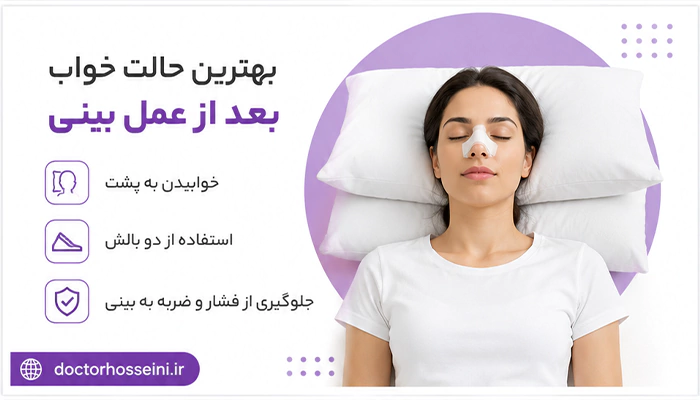 بعد از عمل بینی سر باید چگونه باشد