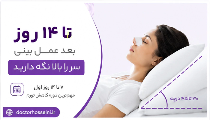 تا چند روز بعد عمل بینی باید سر بالا باشد