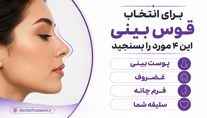 قوس بینی