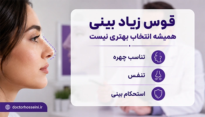 قوس زیاد بینی