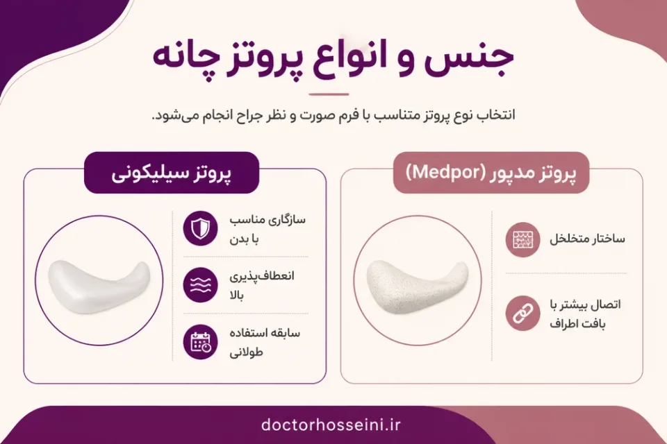 نمای توضیحی درباره جنس و انواع پروتز چانه