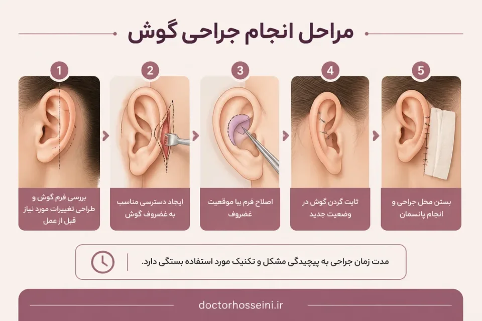 نمای توضیحی درباره مراحل انجام جراحی گوش