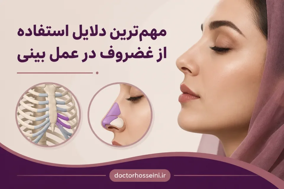 نمای توضیحی درباره مهمترین دلایل استفاده از غضروف در عمل بینی
