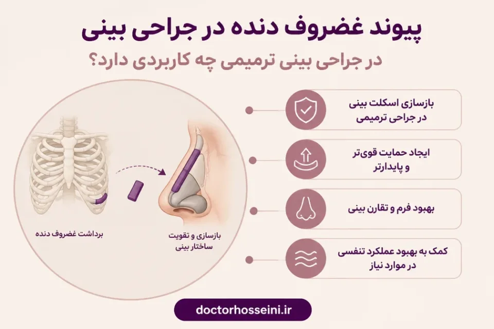 نمای توضیحی درباره پیوند غضروف در جراحی بینی ترمیمی چه کاربردی دارد