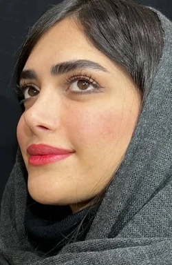 نمونه کار جراحی بینی 3