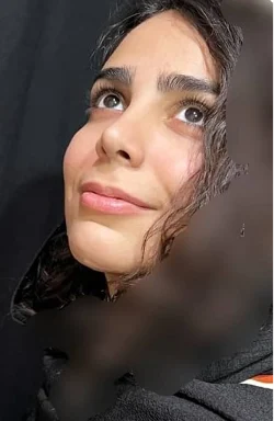 نمونه کار جراحی بینی 4