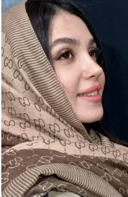 نمونه کار جراحی بینی 5
