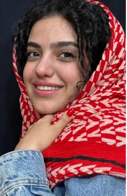 نمونه کار جراحی بینی 6