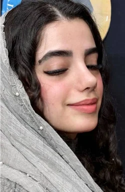 نمونه کار جراحی بینی 7